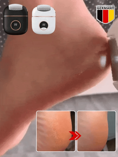 New Digital Digital Electric Foot Polisher